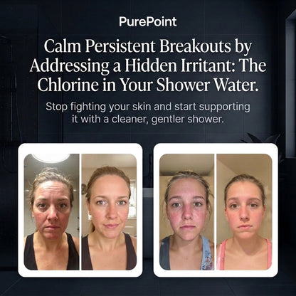 Filtered Showerhead
